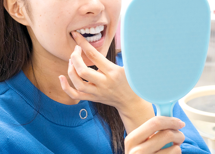 ホームホワイトニング治療の様子