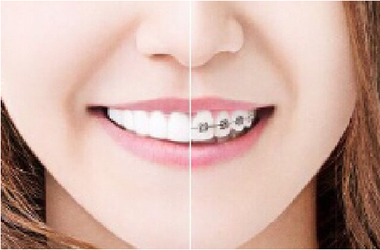 透明度が高いので目立たない