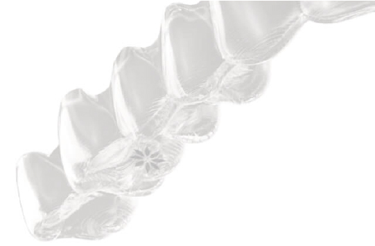 金属アレルギーの方も安心