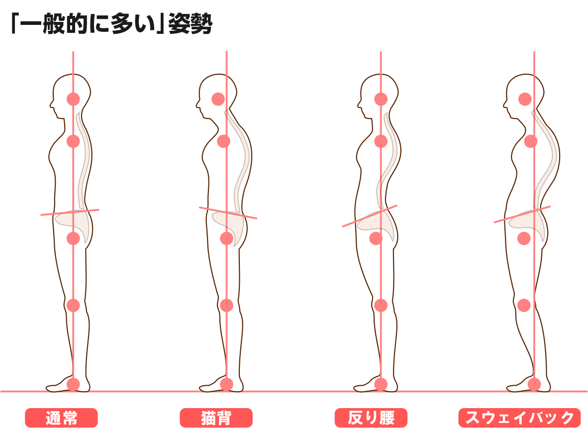 一般的に多い姿勢