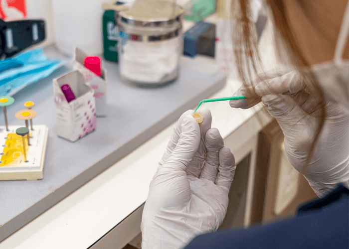 セラミック歯の接着風景