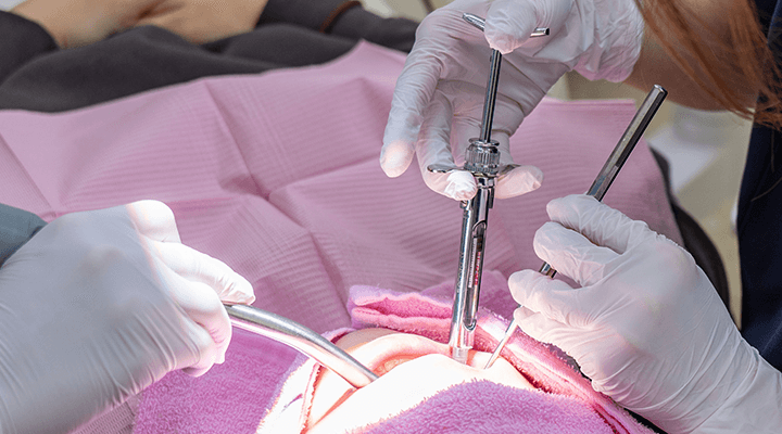 施術前の麻酔の様子