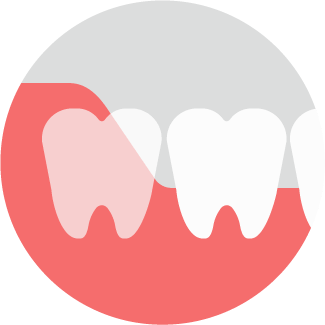 半埋伏智歯イラスト