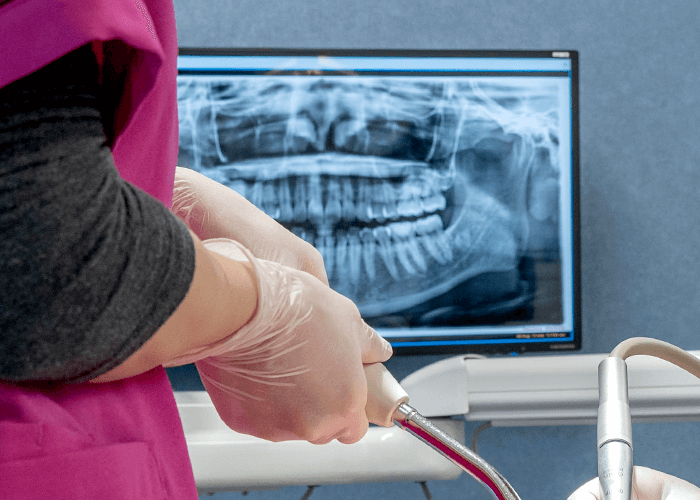 モニターに映るレントゲン写真