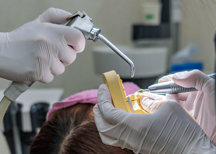 セラミックの噛み合わせを調整