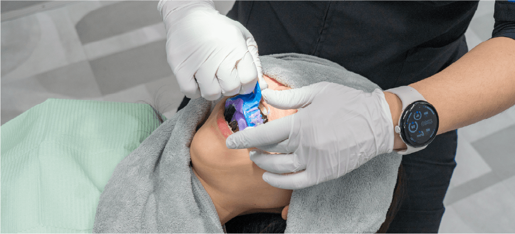 お口の撮影・歯の型取りの画像