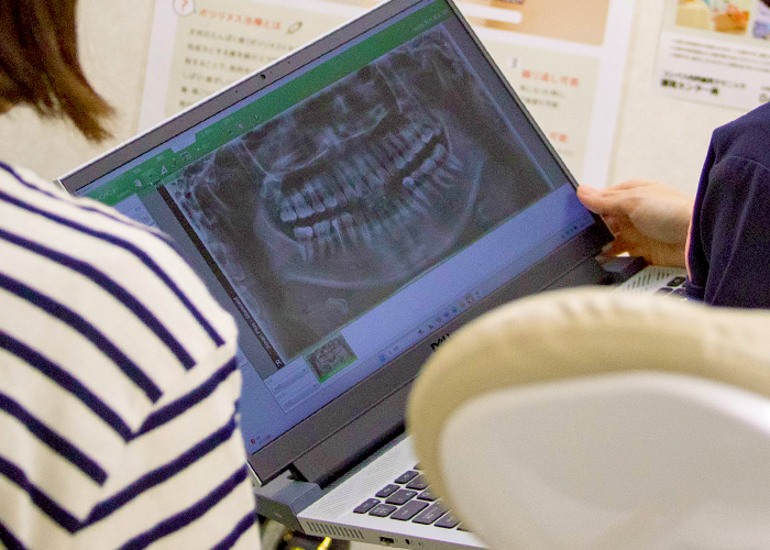 親知らずのレントゲンを見せてのカウンセリング